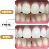 image:imageLumineux Longevity Whitening Kit Bundle  Contains 6X Toothpastes 6X Mouthwashes 2X Strips and 2X Whitening Pens  Enamel Safe and Clinically Proven to Whiten Without The Sensitivity