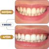 image:imageLumineux Longevity Whitening Kit Bundle  Contains 6X Toothpastes 6X Mouthwashes 2X Strips and 2X Whitening Pens  Enamel Safe and Clinically Proven to Whiten Without The Sensitivity